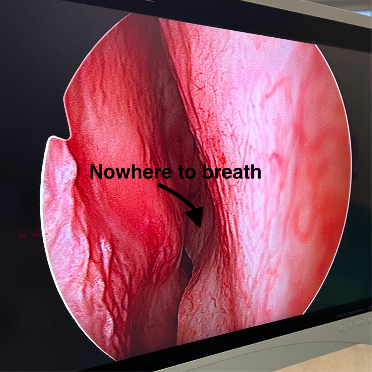 nowhere-to-breath-img